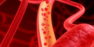 Triglycerides trop bas ou eleves : que faire pour avoir un taux normal de triglycerides ?