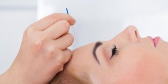 Cephalees : l-acupuncture, traitement miracle contre les maux de tete ? 