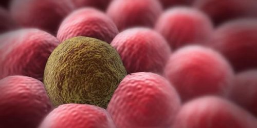 Cancer : symptomes, causes, traitement, taux de survie 