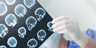Parkinson : l’ortie, un traitement novateur !