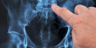 Discopathie degenerative, L5 S1, L4 L5, lombaire : comment la soigner ?