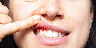 Ces fruits sont les meilleurs pour les gencives et les dents selon une etude !
