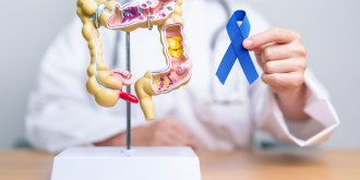 Cancer colorectal (colon ou rectum) : a quel age est-on plus a risque ? 