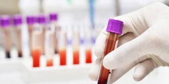 Maladie de Charcot : une simple prise de sang pour la diagnostiquer ?
