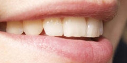 Soignez vos dents au meilleur prix!