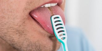 Langue qui brule et qui pique : un signe de mycose ?