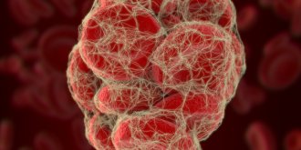 Embolie pulmonaire : quels sont les departements les plus touches ?