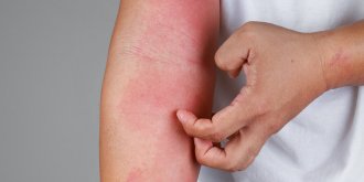 Quel est le lien entre allergie alimentaire et medicaments ?
