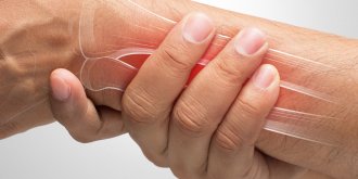Fractures de fragilite : une augmentation qui inquiete, les gestes pour prevenir