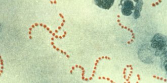 Scarlatine : symptomes (bouton, plaque rouge), contagion, traitements