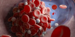Caillot : 7 signes qui doivent alerter apres le vaccin JohnsonJohnson