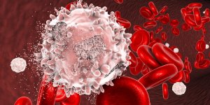 Cancer qui regresse tout seul : est-ce vraiment possible ?