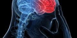 AVC : comment eviter la recidive