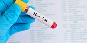Taux de cholesterol : qu-est-ce que la lipoproteine HDL ?