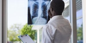 Metastase pulmonaire : quel pronostic ?