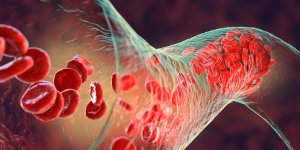 Des nuits plus courtes favorisent les maladies arterielles peripheriques