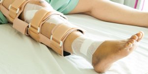 Fracture du femur chez une personne agee : quels traitements ?