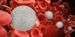 Lymphomes agressifs : le lymphome de Burkitt