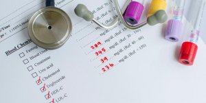Bilan lipidique : les valeurs normales