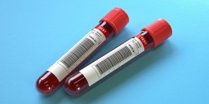 Alat eleve mais asat normal : notre guide pour comprendre le fonctionnement des maladies du foie 