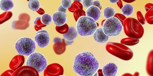 Le medicament Azantac® contre les brulures d-estomac serait cancerigene !