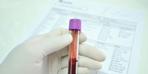 Diabete : le taux normal de sucre dans le sang chez l-adulte