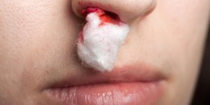 Saignement du nez : un signe de cancer du foie ?
