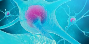 Maladie des nerfs : la neuropathie peripherique