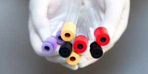 Taux de cholesterol : comment le mesurer ?
