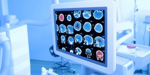 Traitement de la tumeur du cerveau : l-operation