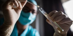 Covid-19 : il peut alterer le systeme immunitaire