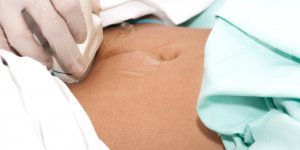 Grossesse extra-uterine : le diagnostic