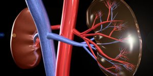 Les 3 maladies des reins les plus frequentes