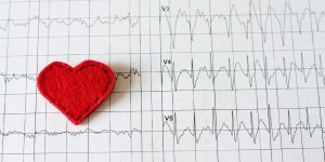 Tachycardie : les autres causes que le stress