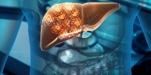 Cancer du foie : quelles sont les personnes a risque ? 