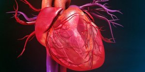Infarctus : certains stents pourraient-ils conduire a des risques hemorragiques ? 