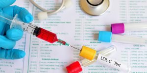 Taux de cholesterol : qu-est-ce que la lipoproteine LDL ?