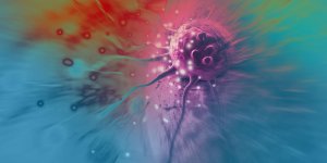 Cancer : bientot un gel a pulveriser sur le corps pour prevenir les metastases ?