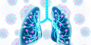 Covid-19 : premiere greffe pulmonaire en France