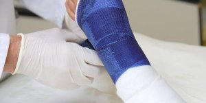 Osteoporose fracturaire : definition