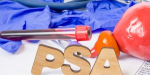 Peut-on faire baisser le taux de PSA ?