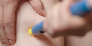 AVF : les conseils d’une patiente pour se faire les piqures 