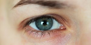 Melanome uveal : un cancer oculaire rare a detecter tot