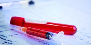 Glycemie : le taux normal en mmol