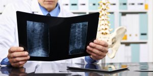 Arthrose lombaire : comment se passe l-examen au scanner