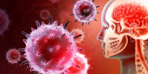 Covid-19 : il peut provoquer des encephalites, alerte un neurologue