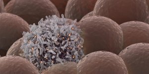 Metastases au foie : l-esperance de vie