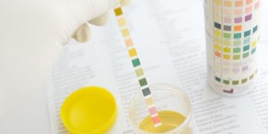 Ce que votre urine peut reveler de votre sante