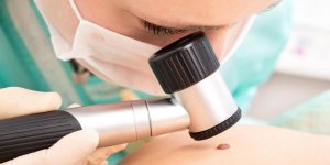 Carcinome basocellulaire nodulaire : comment le depister ?
