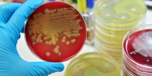 Une bacterie dangereuse menace les hopitaux du monde entier
